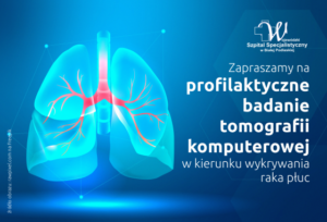 Szpital specjalistyczny w Białej Podlaskiej zaprasza na profilaktyczne badanie tomografi komputerowej w kierunku raka płóc